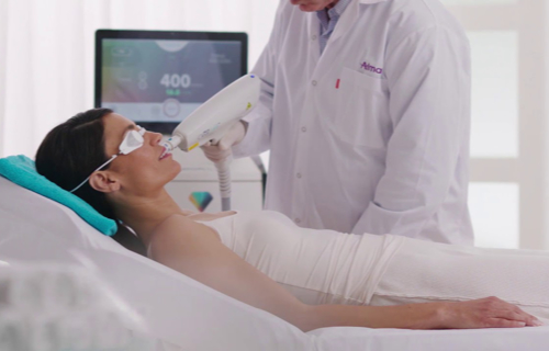 laser skin rejuvenation anti ageing